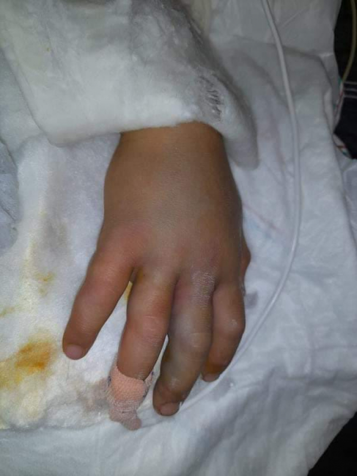 Siirt'te Yılanın Isırdığı Çocuk Yaralandı