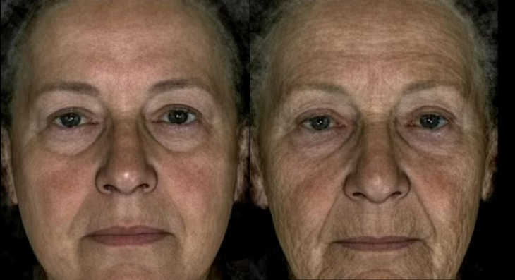 Bilimsel araştırma: Olduğundan yaşlı görünmek hastalık belirtisi olabilir