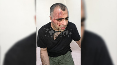 Siirt Barosundan Gazeteci Sinan Aygül'e yönelik Saldırıya Kınama