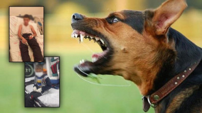 Sokak köpeğinin ısırdığı 10 yaşındaki çocukla ilgili acı gerçeği doktoru paylaştı